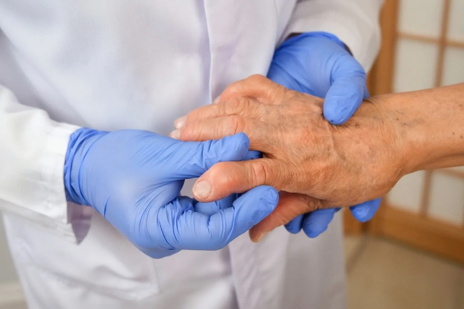 Early treatment significantly reduces joint damage in rheumatoid arthritis